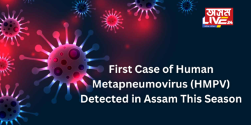 First Case of Human Metapneumovirus (HMPV) Detected in Assam This Season